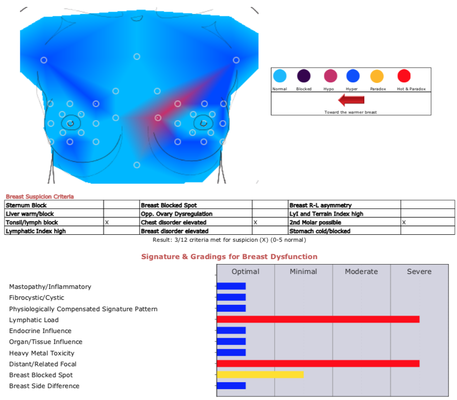 Thermography Breast scan 3 months later