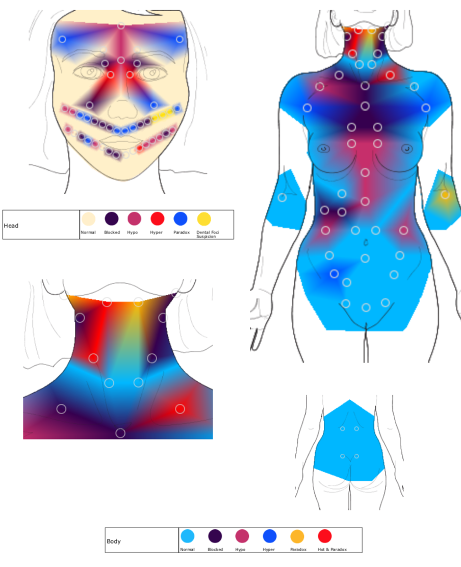 Initial Body Thermography Scan