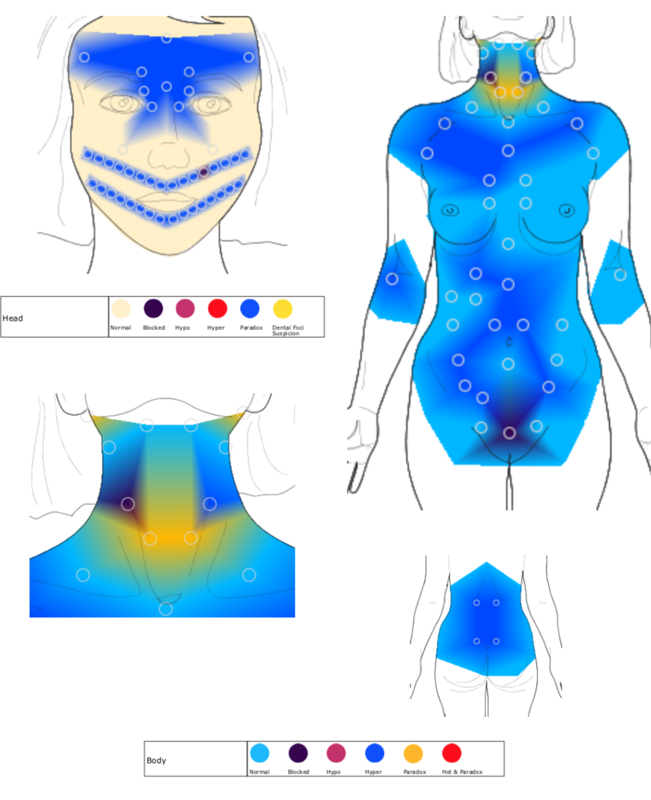 Body Thermography Scan 4 months later