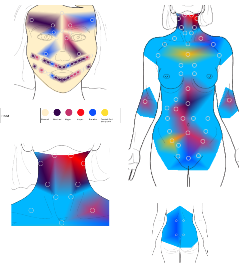 Thermography Body scan 2 months later