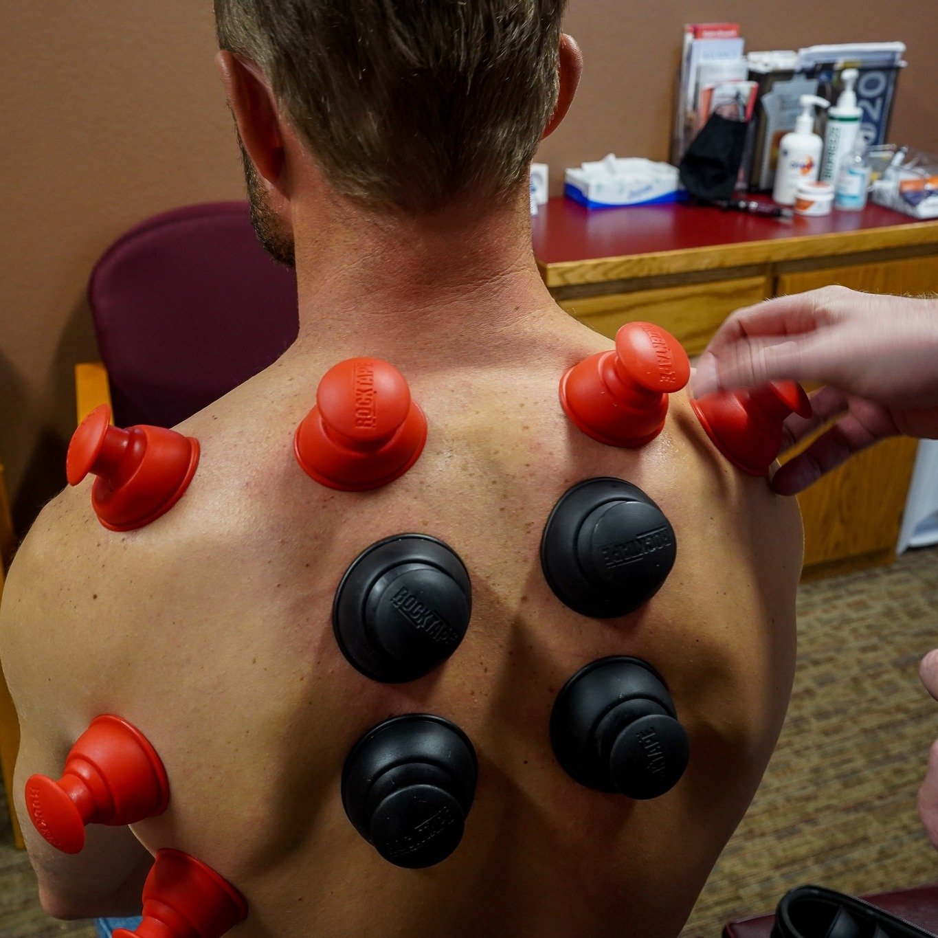 What are these? 

This is a therapy called cupping, which leaves circle-shaped bruises behind for a few days afterward. Cupping is a great way to decompress tissue and bring blood flow to a painful area in the body to promote healing.
 
A recent pati