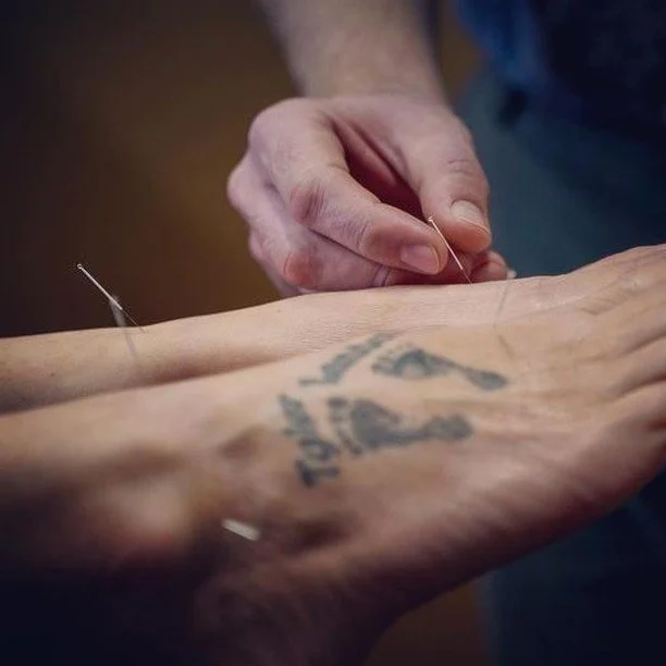 Did you know that our chiropractors are also certified in acupuncture? We utilize acupuncture for its long list of benefits, including stress relief, pain relief, better sleep, reduced inflammation, and speeding healing. 

Some of the most common thi