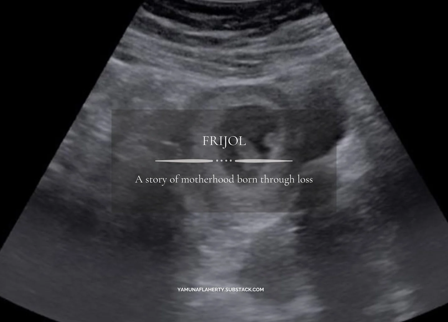 This week, I&rsquo;m honoring Pregnancy and Infant Loss Awareness Week by sharing Frijol&mdash;a story about motherhood through loss, and the unseen ways we continue to nurture life.

You can read it now on The Long Road Home. 🌱