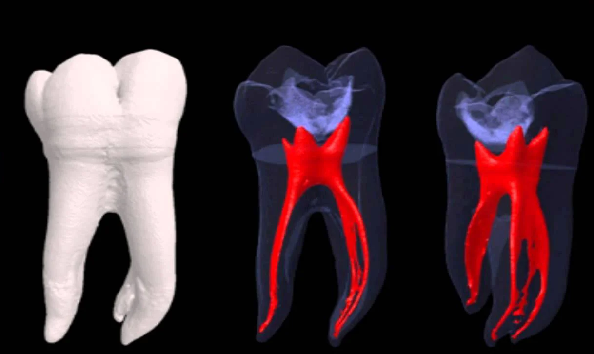 Root-Canal.jpg