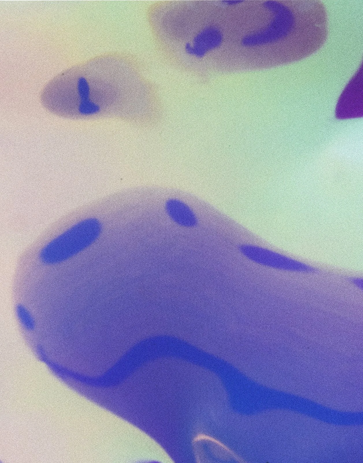 Phabies presents: the Curse of Caring