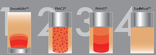 4 anti-aging laser modes Courtesy of Fotona