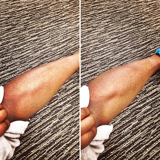 Relaxed vs. Flexed