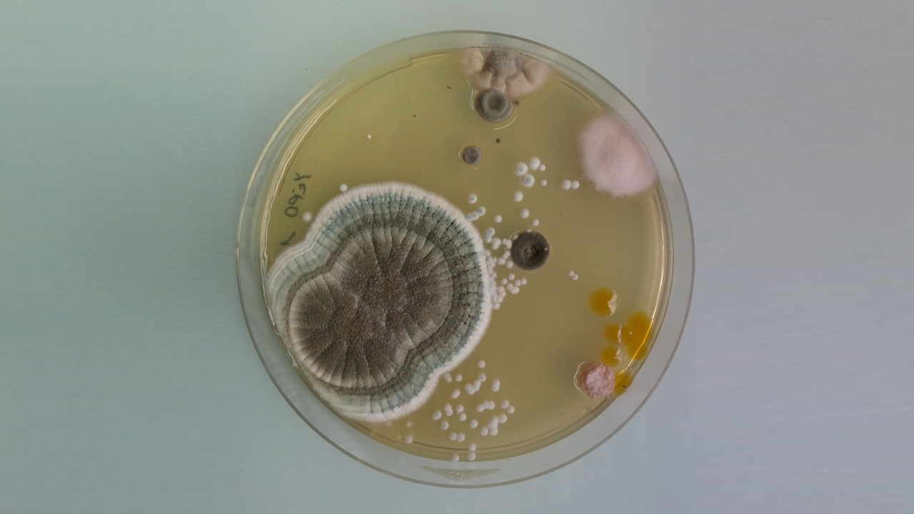 <a href=" http://animalnewyork.com/2013/abstract-moldy-petri-dish-art-is-pretty-gross/ " target="_blank">link</a>