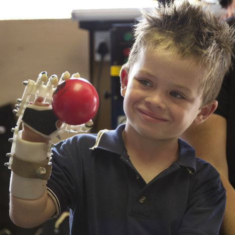 <a href=" http://www.dezeen.com/2013/05/29/3d-printed-robohand-helps-children-born-without-fingers/ " target="_blank">link</a>