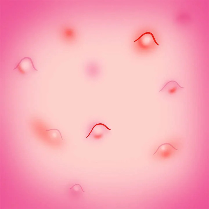 Pimples.jpg