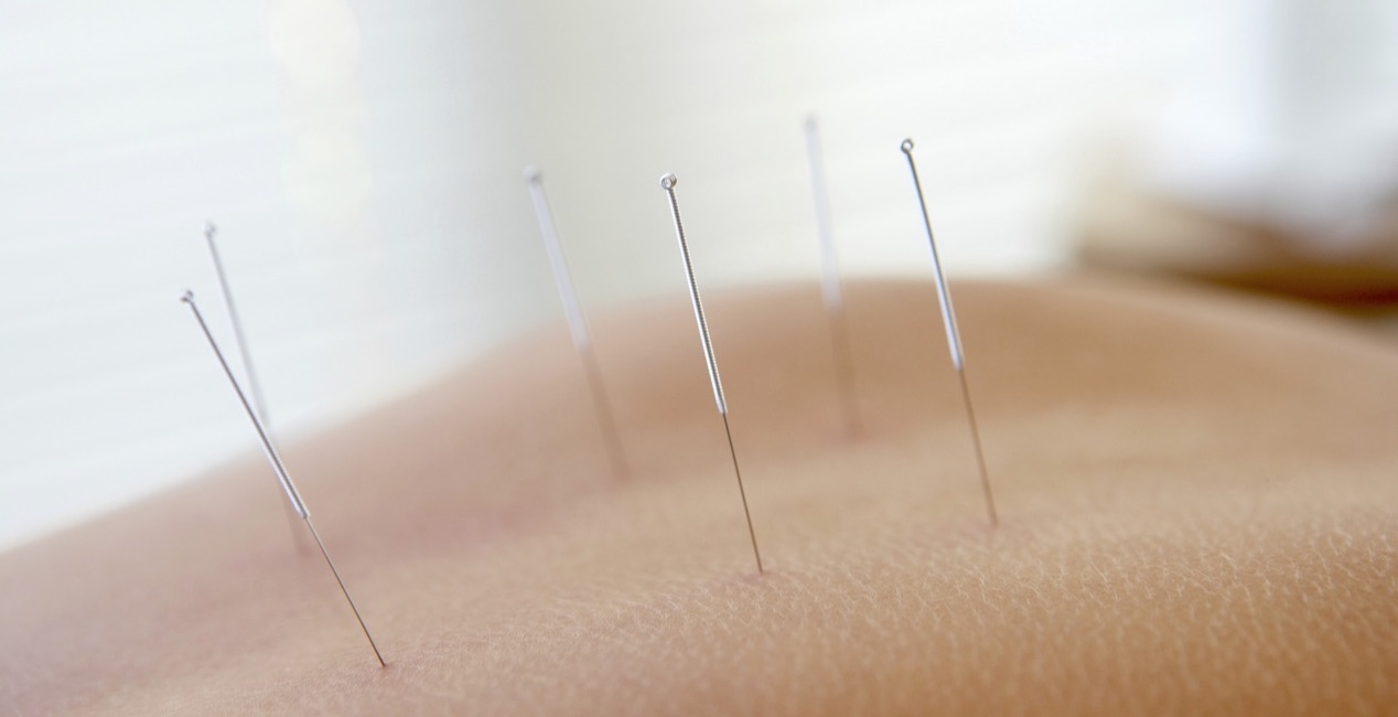 Yoga_Acupuncture_Dawn_Hayes_Deva_Robinson.jpg