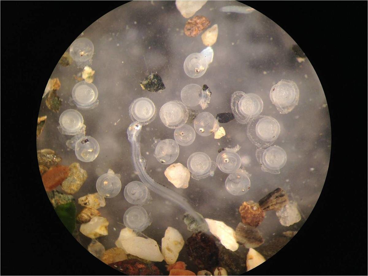  Forage fish eggs as seen under a microscope 