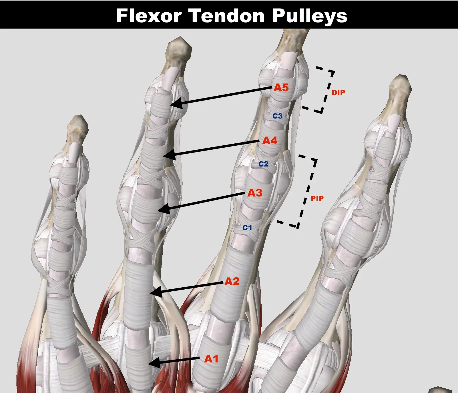 Taping for Finger Injuries — Grassroots Physical Therapy