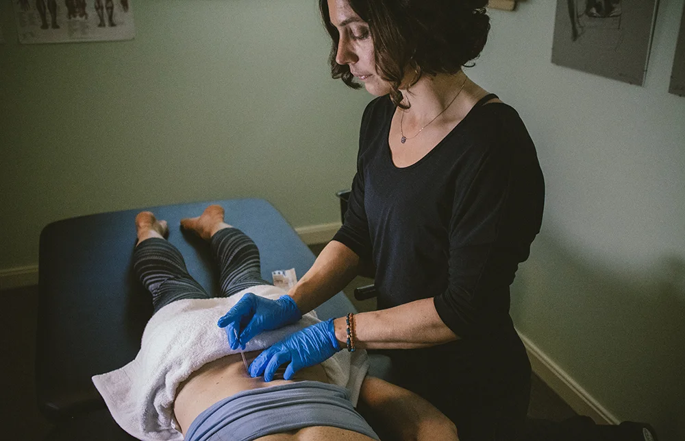 Dry Needling Therapy