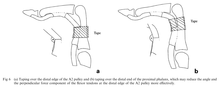 Image 1 -Schweizer, A2 Pulley Taping Application Sites.png