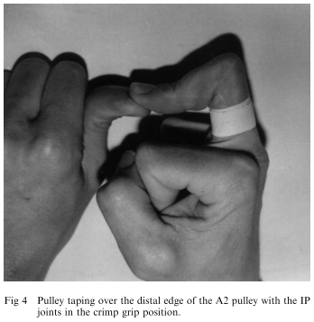 Image 2 - Schweizer Circumferential Tape at A2.png