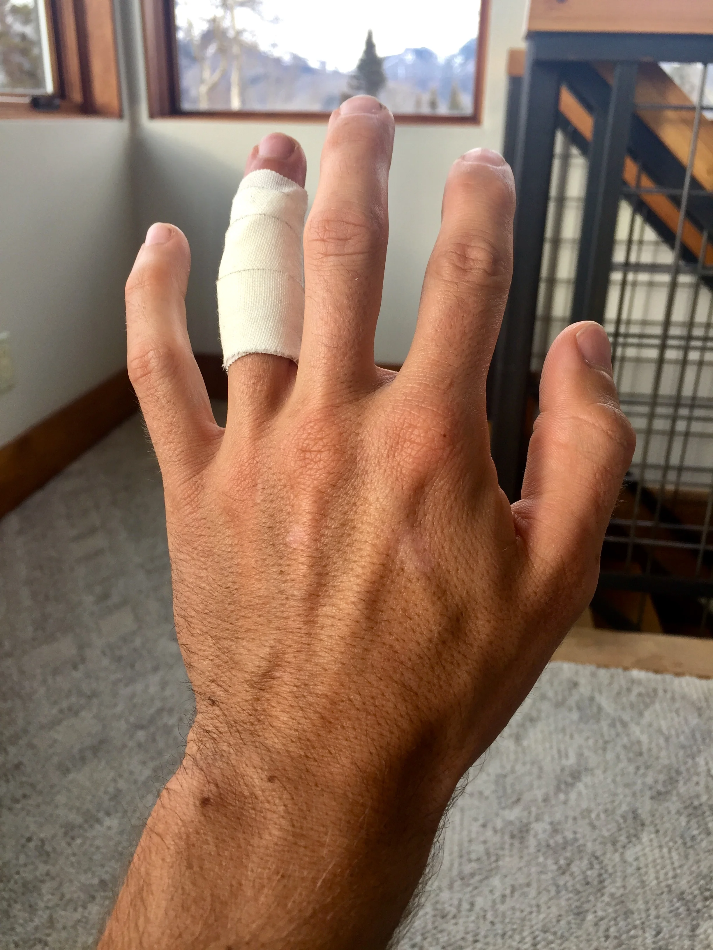 Image 18 - PIP Splinting 1.jpg