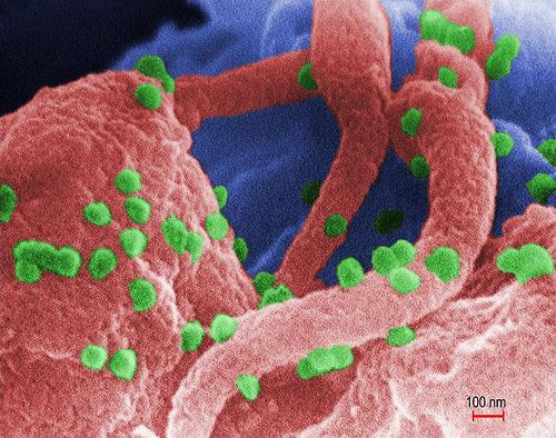 Human Immunodeficiency Virus (HIV-1) Photo Credit: C. Goldsmith, P. Feorino, E. L. Palmer, W. R. McManus, CDC / Microbe World