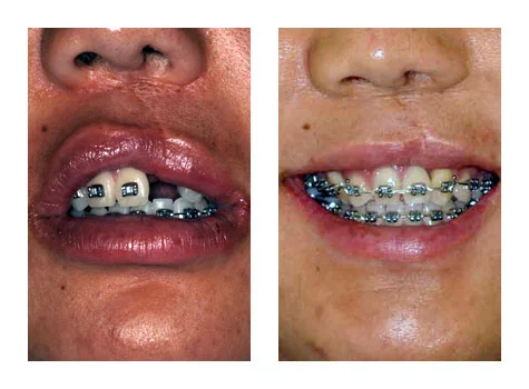 prior treatment.jpg