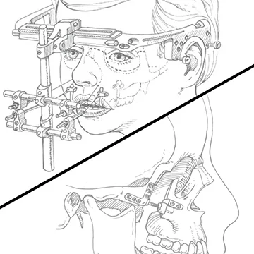 technique-comparison-for-web.jpg