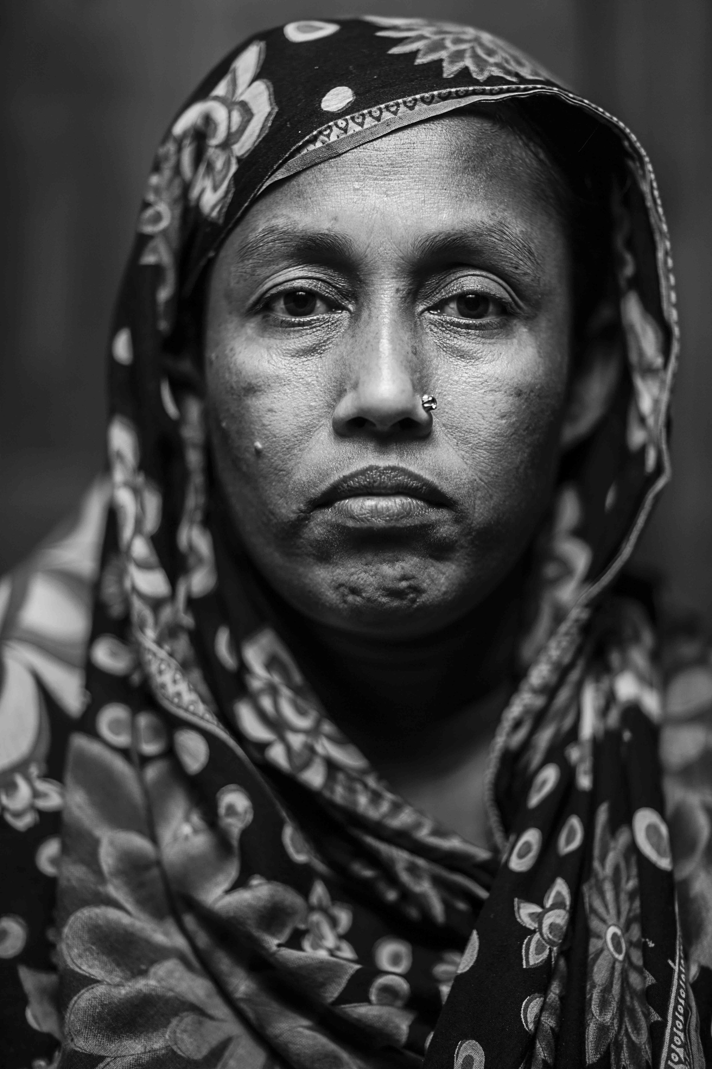  Nasima Begum, wife of Rubel, has been beside her husband’s bed since November. They have two young sons in Comilla and are finding it hard to support their family.      