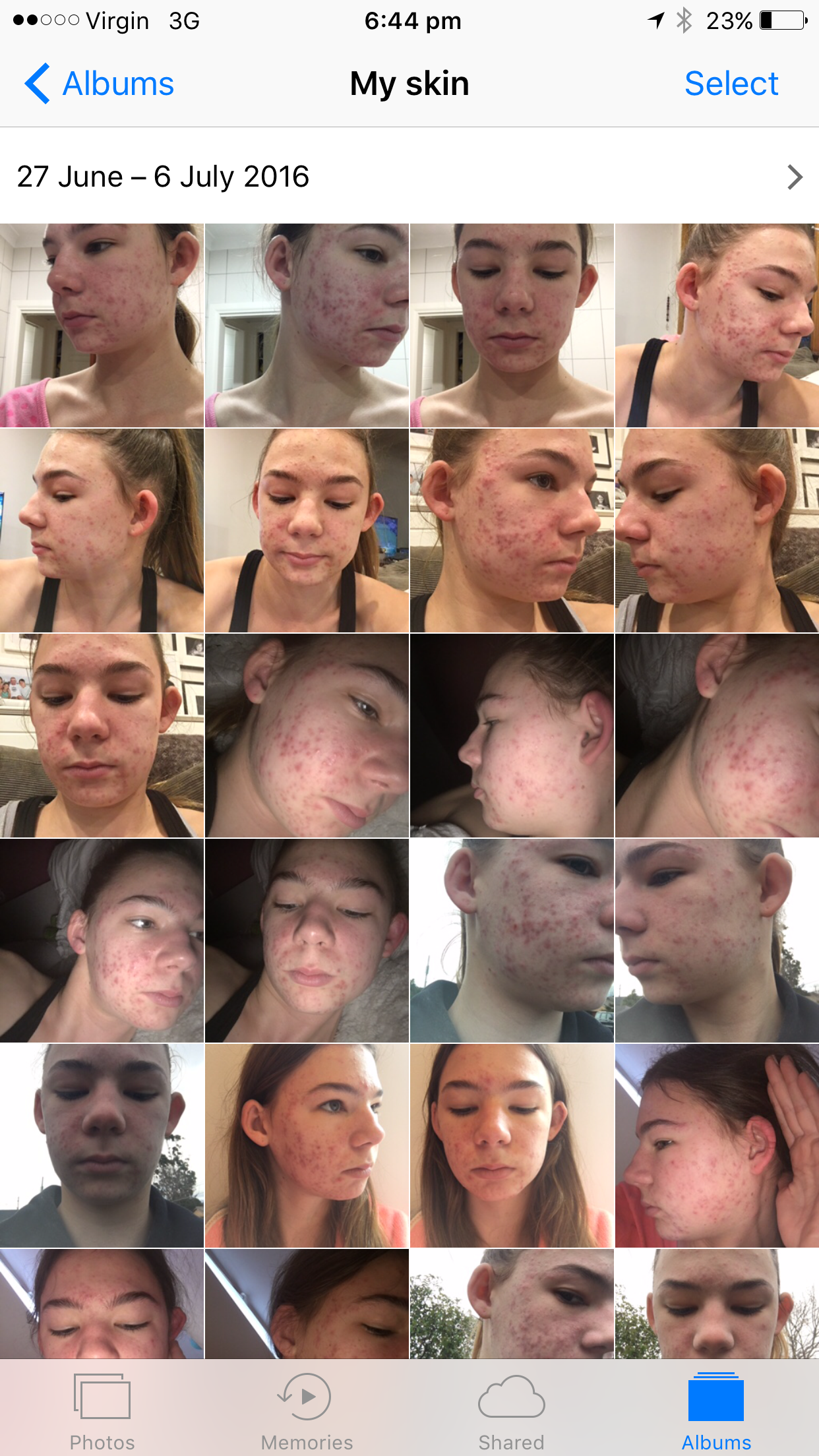 enzyme therapy facial near me