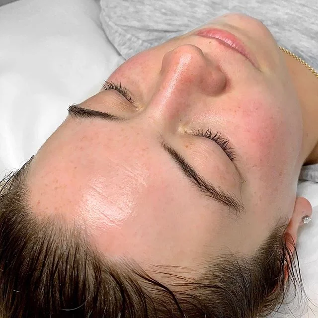 From GOOD to GLOW β¨β£
β£
Not all skin journeys are about correction. A lot of skins we work with already rock happy and healthy skin, and are simply searching for long term management and maximizing the health of their skin. β£
β£
 #FindYourGlow #LaserGe