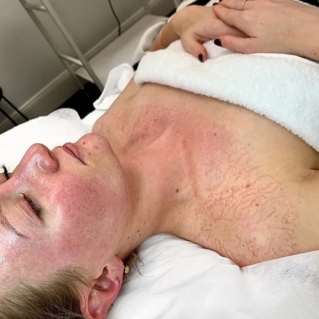 PEEL + PRIN COMBO β£οΈβ£οΈβ£οΈβ£
β£
Happy healthy skin! We always preach that the body knows how to exfoliate itself. But sometimes it doesn’t do it. We work with the skin to help it do what it knows how to do, but modern life can sometimes be at odds