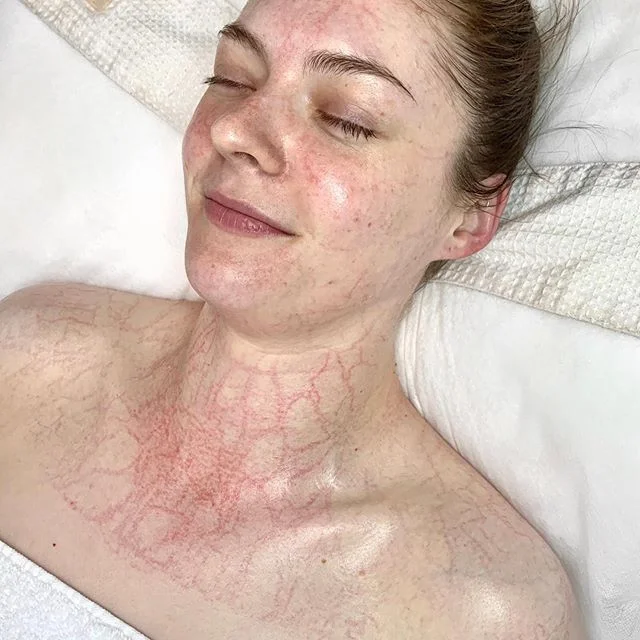 OH THAT PRIN GLOW β¨β¨β¨β£
β£
Tighter and tighter the mask gets (!!!) gently compressing the skin, creating downward pressure that assists the body in moving blood flow and lymph (the system that has no pump and relies on movement!), giving your skin the