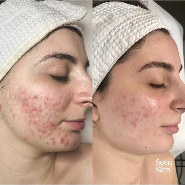 HELLO GORGEOUS. GORGEOUS BEFORE AND GORGEOUS AFTER π»ππ½‍βοΈππ§πΌ‍βοΈπ―β¨π₯°πππ½