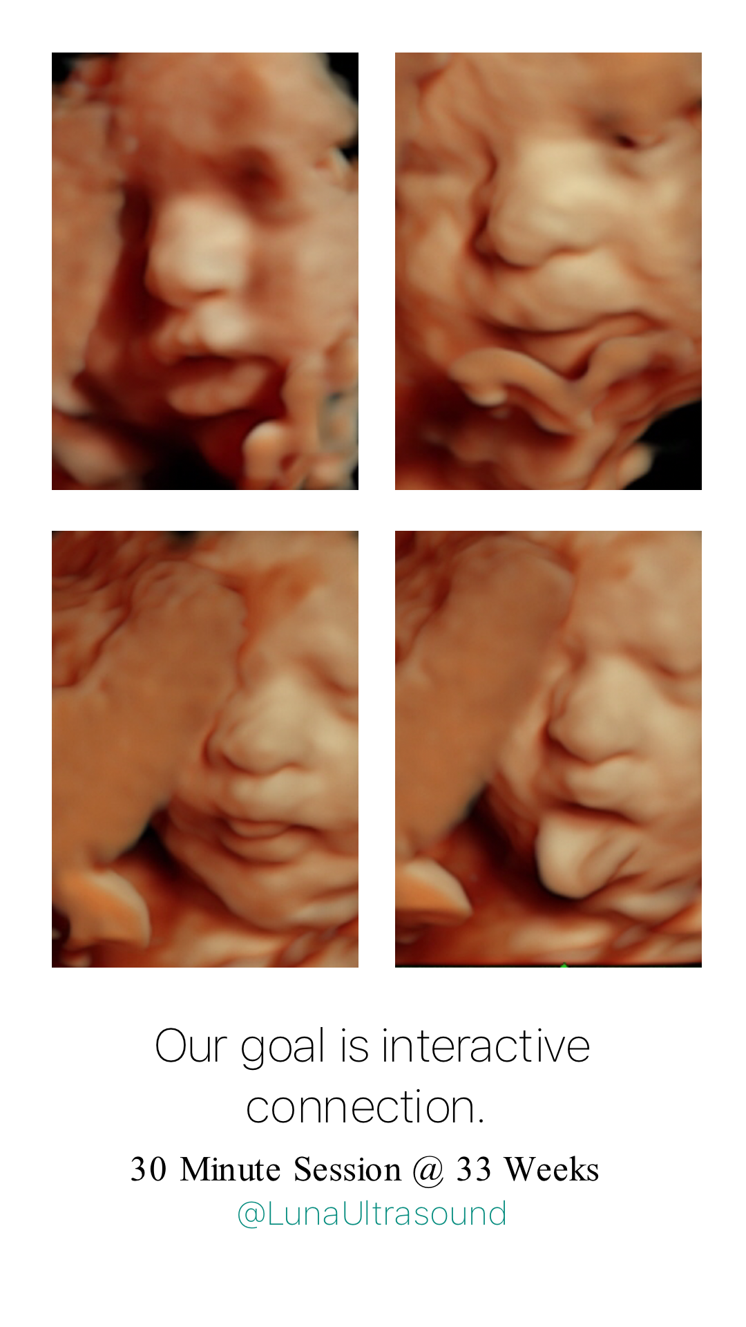 30 Minute 4D/HD Ultrasound