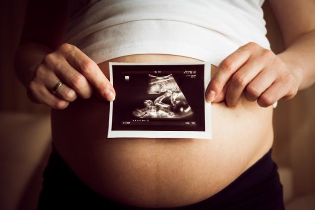 ultrasound_on_belly.jpg