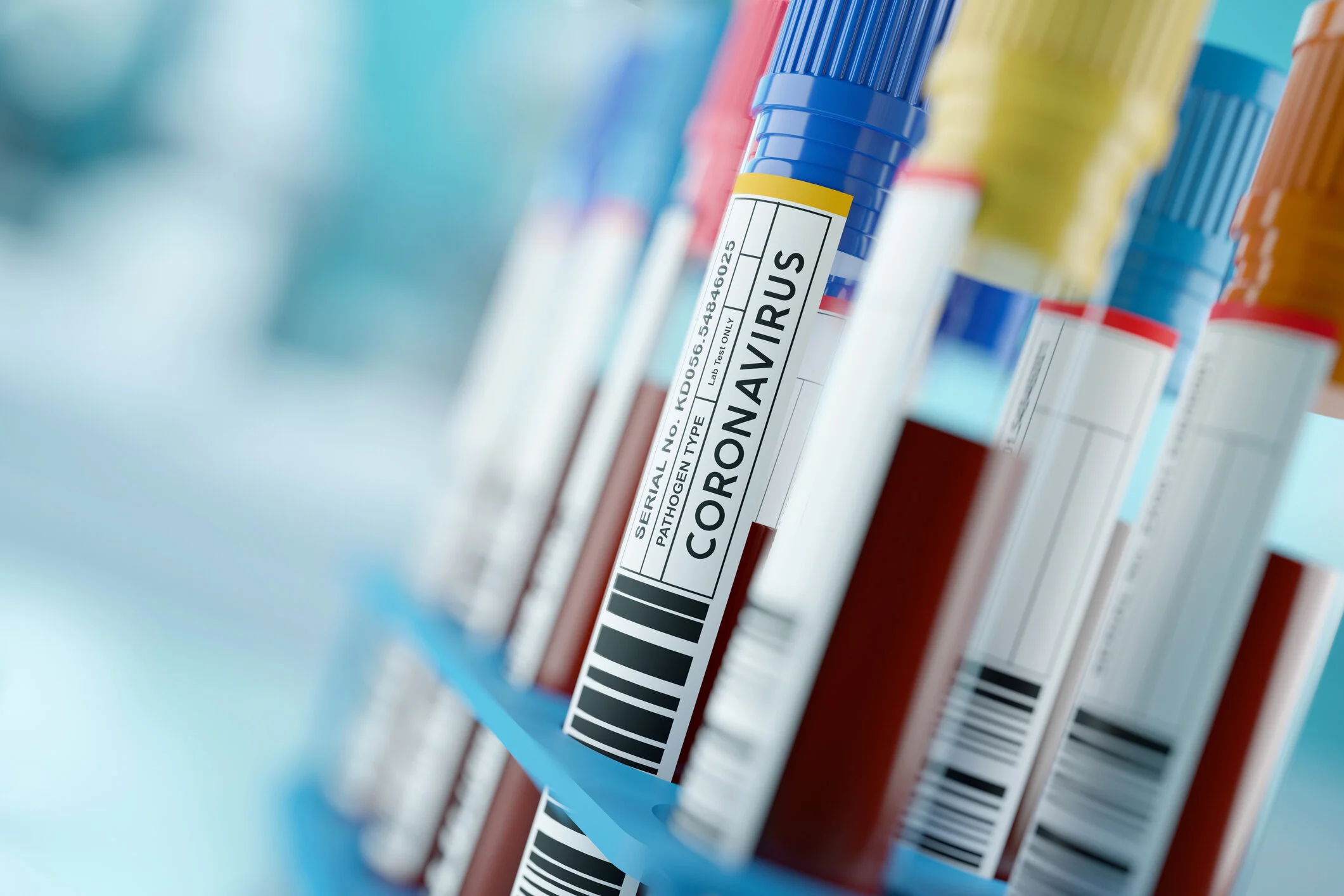 Rochester scientists develop first-of-its-kind antibody test to detect protective immunity