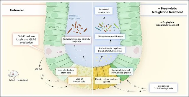 Diagram showing how a treatment may help protect the intestines by supporting healthy gut cells and improving the balance of bacteria in the gut.