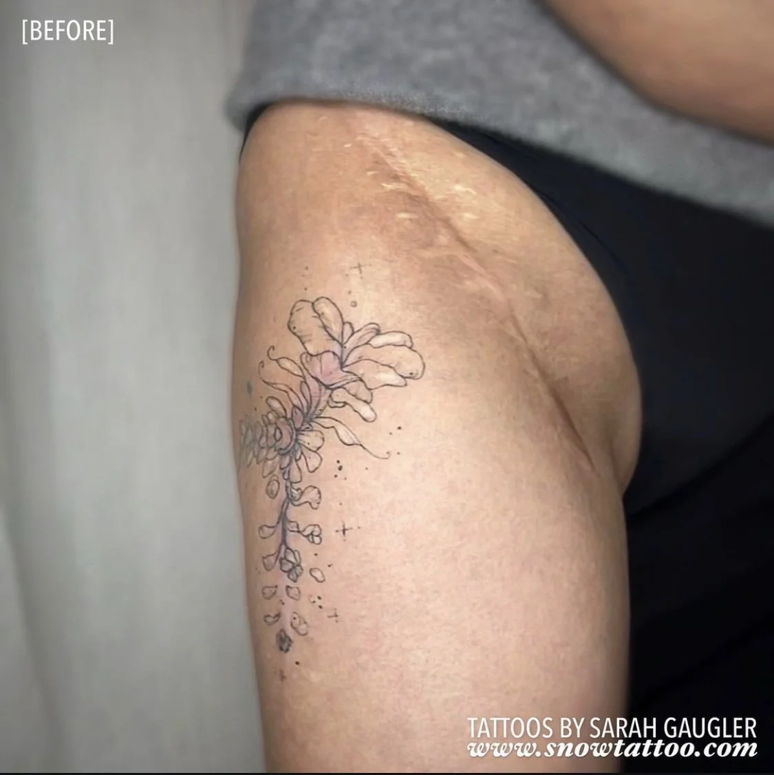 Scar Cover Up Tattoo by Sarah Gaugler at Snow Tattoo New York