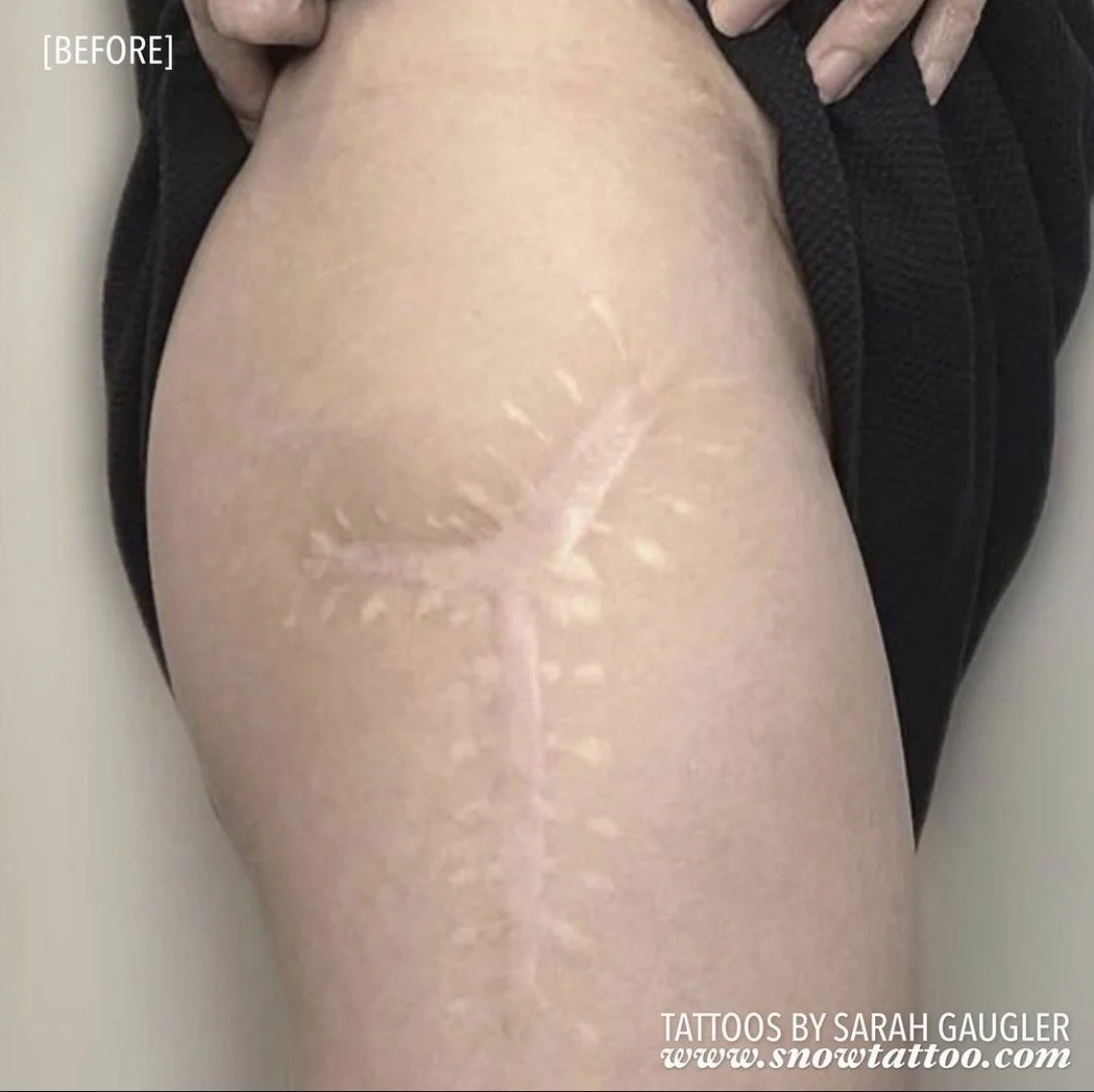 Scar Cover Up Tattoo by Sarah Gaugler at Snow Tattoo New York