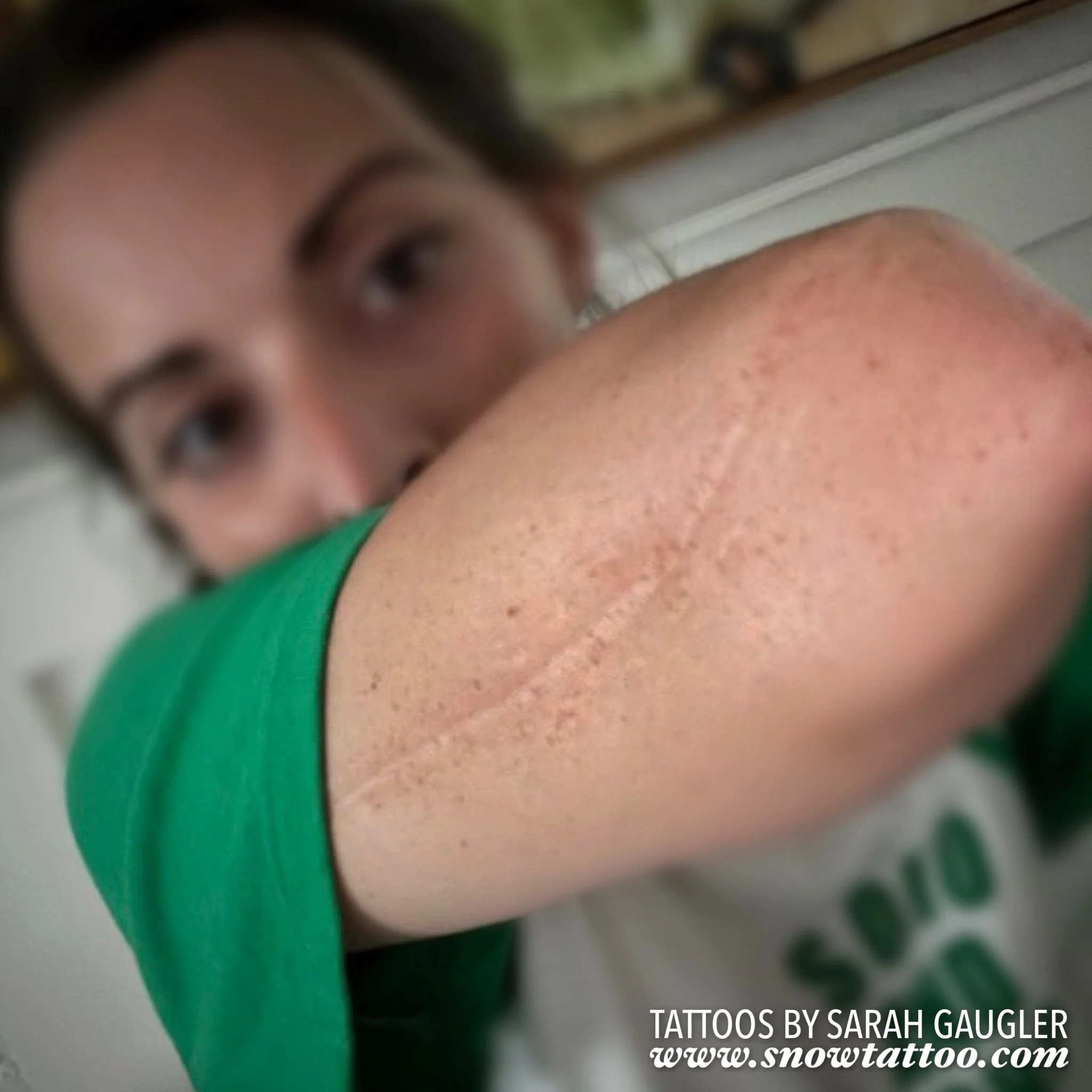 Scar Cover Up Tattoo by Sarah Gaugler at Snow Tattoo New York