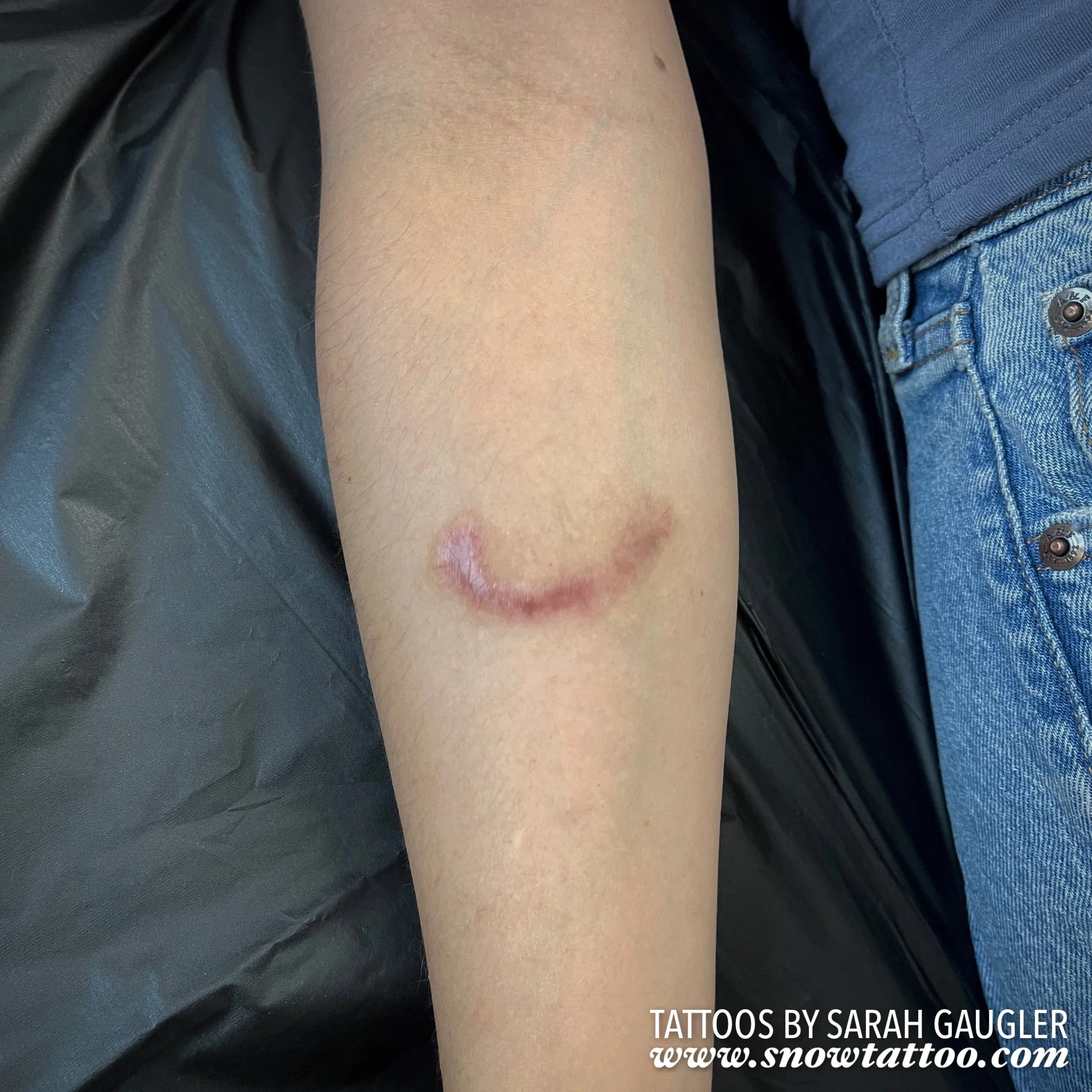 Scar Cover Up Tattoo by Sarah Gaugler at Snow Tattoo New York