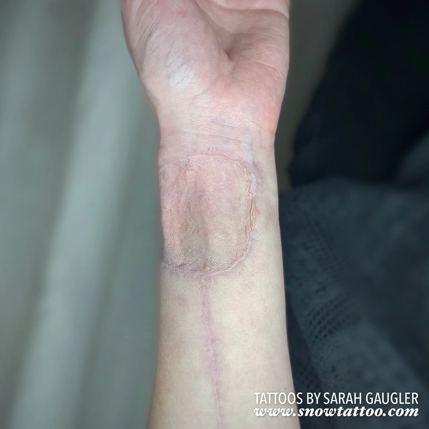 Scar Cover Up Tattoo by Sarah Gaugler at Snow Tattoo New York