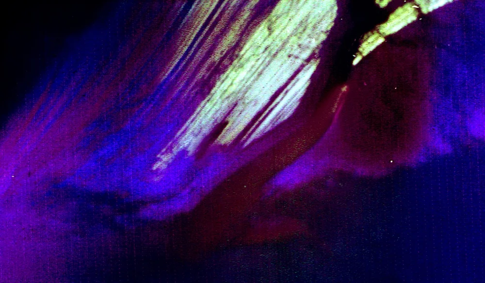 Sharpes Beach NE | 8 Month Exposure