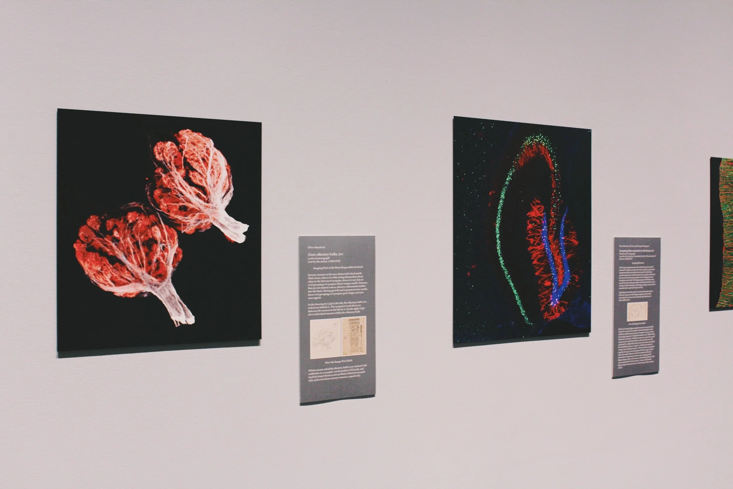 Investigating the Biology of Consciousness