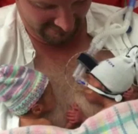Preemie Babies Hold Hands In 'Unbelievable' Moment Captured On Video