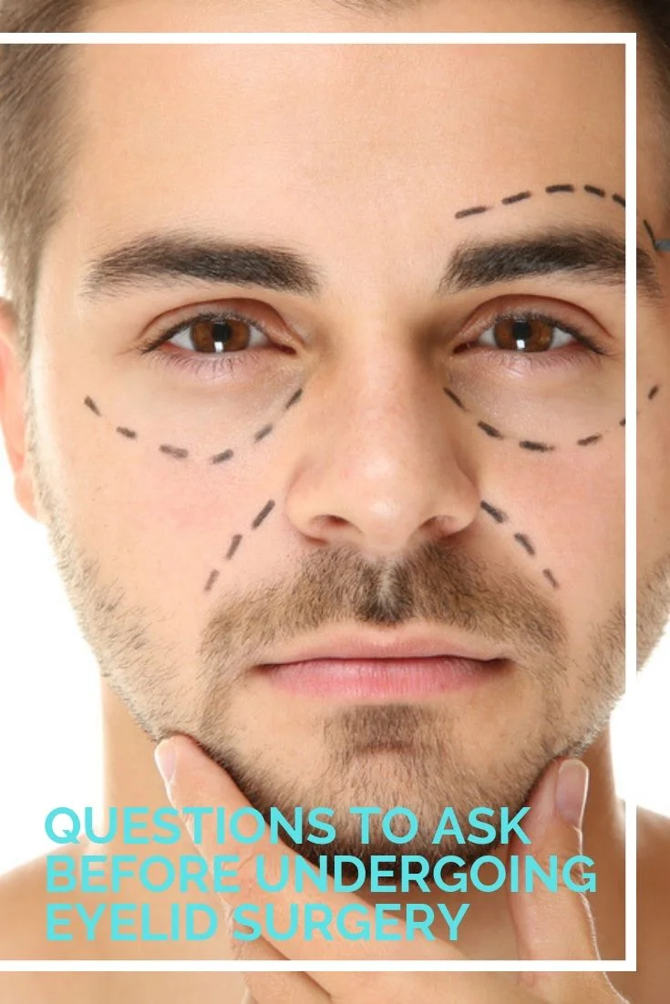 Questions To Ask Before Undergoing Eyelid Surgery Naples