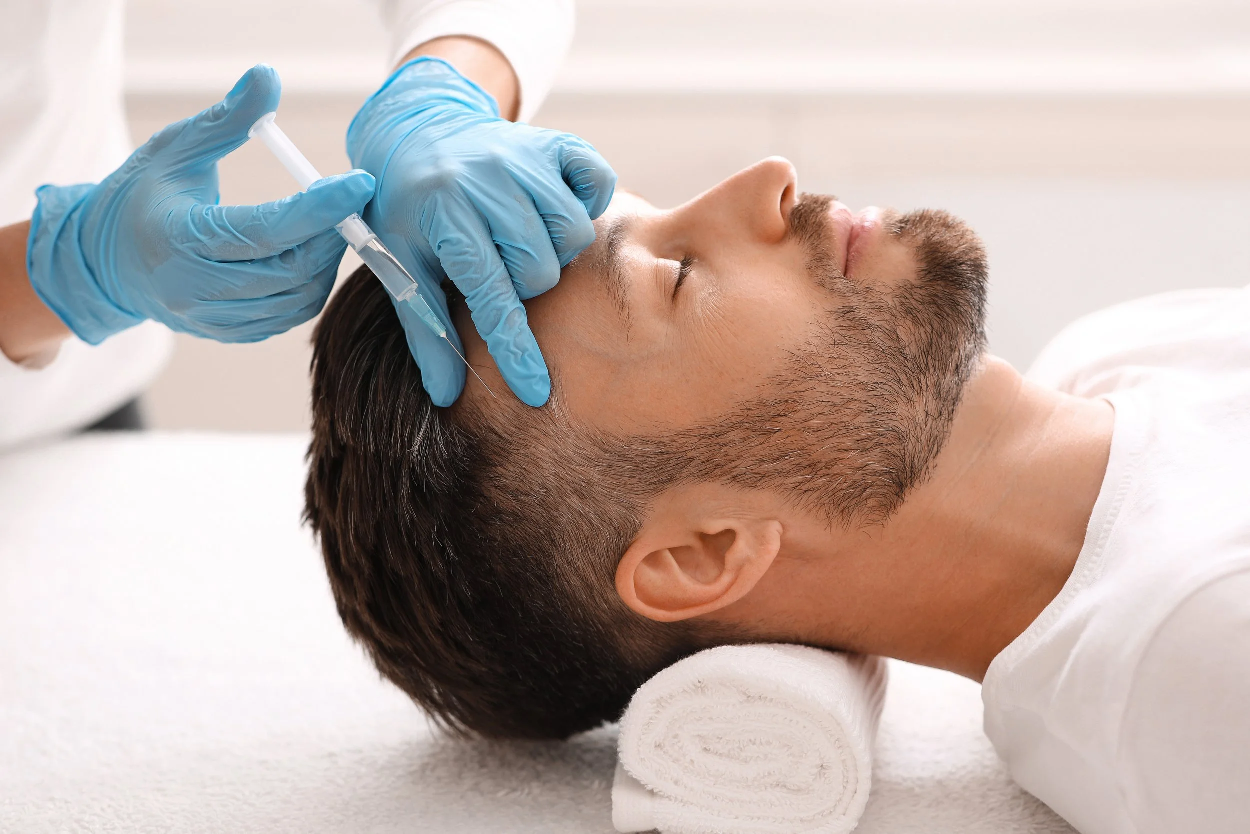 4 Things Men Should Know About Hair Loss