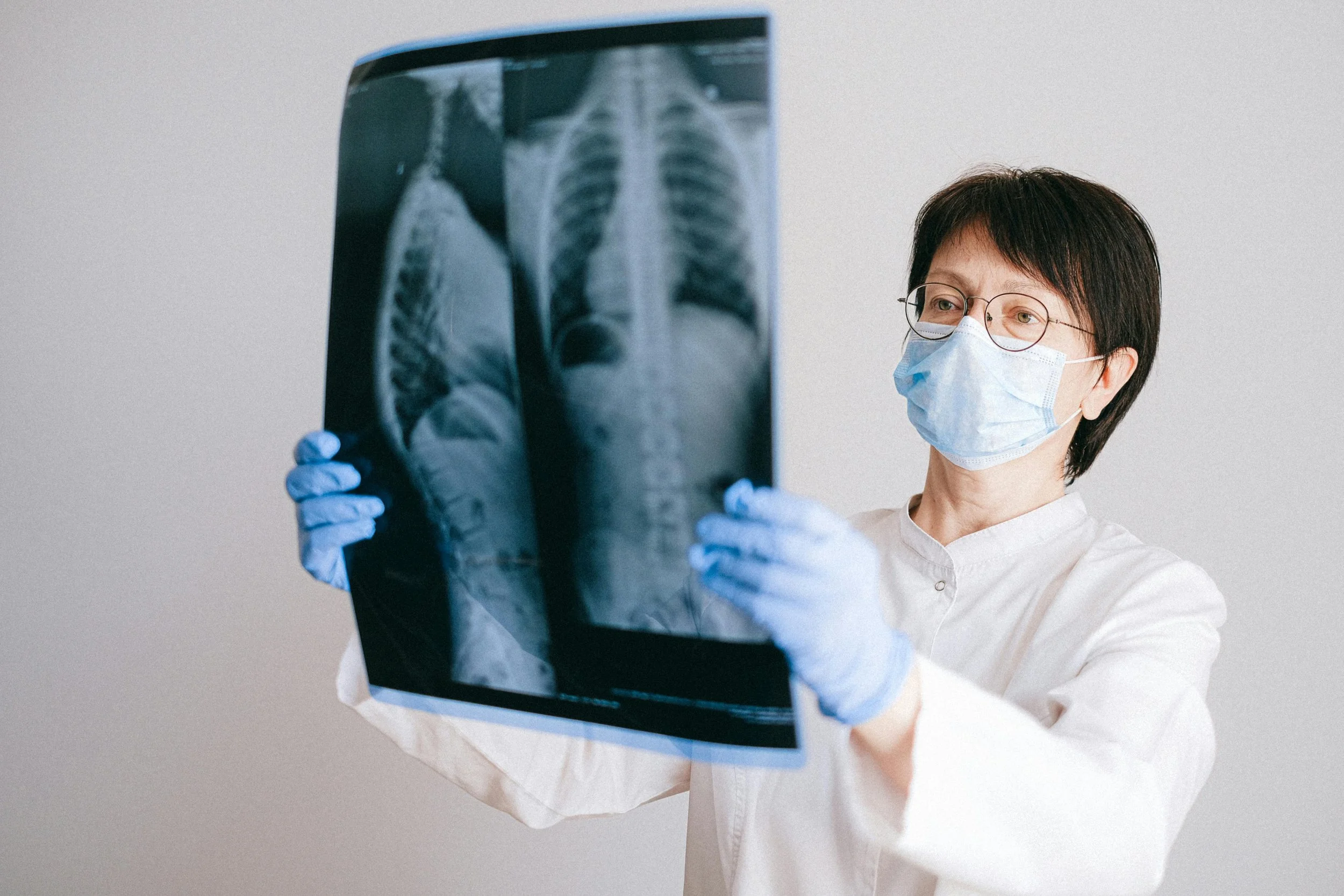 A Doctor Looking at an X-Ray Result