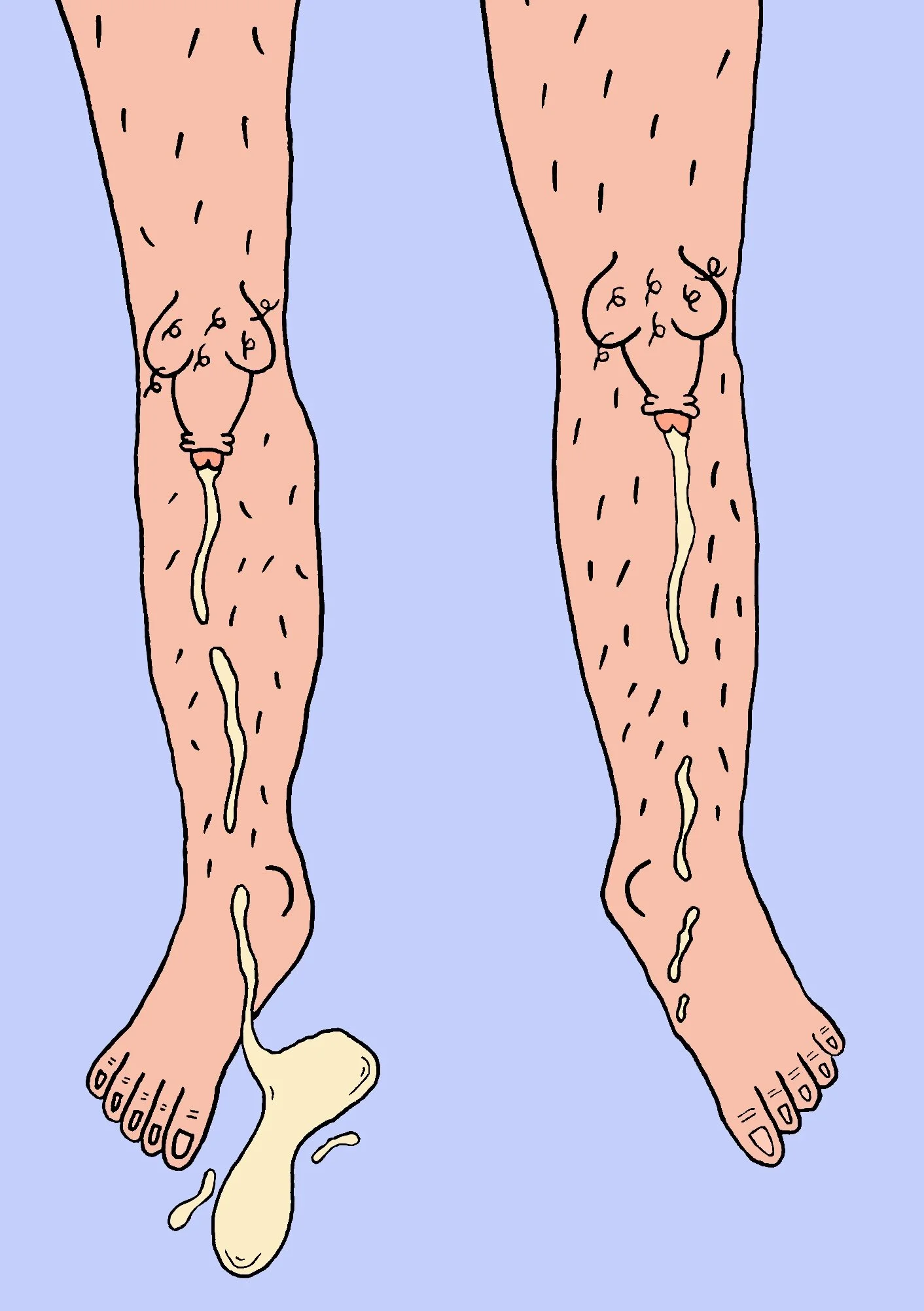 Knobbly Knees JPEG.jpg
