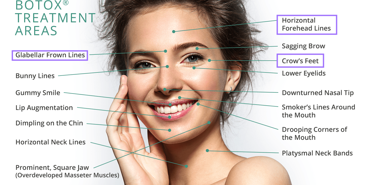 smithandco botox areas miami smithandco botox areas miami