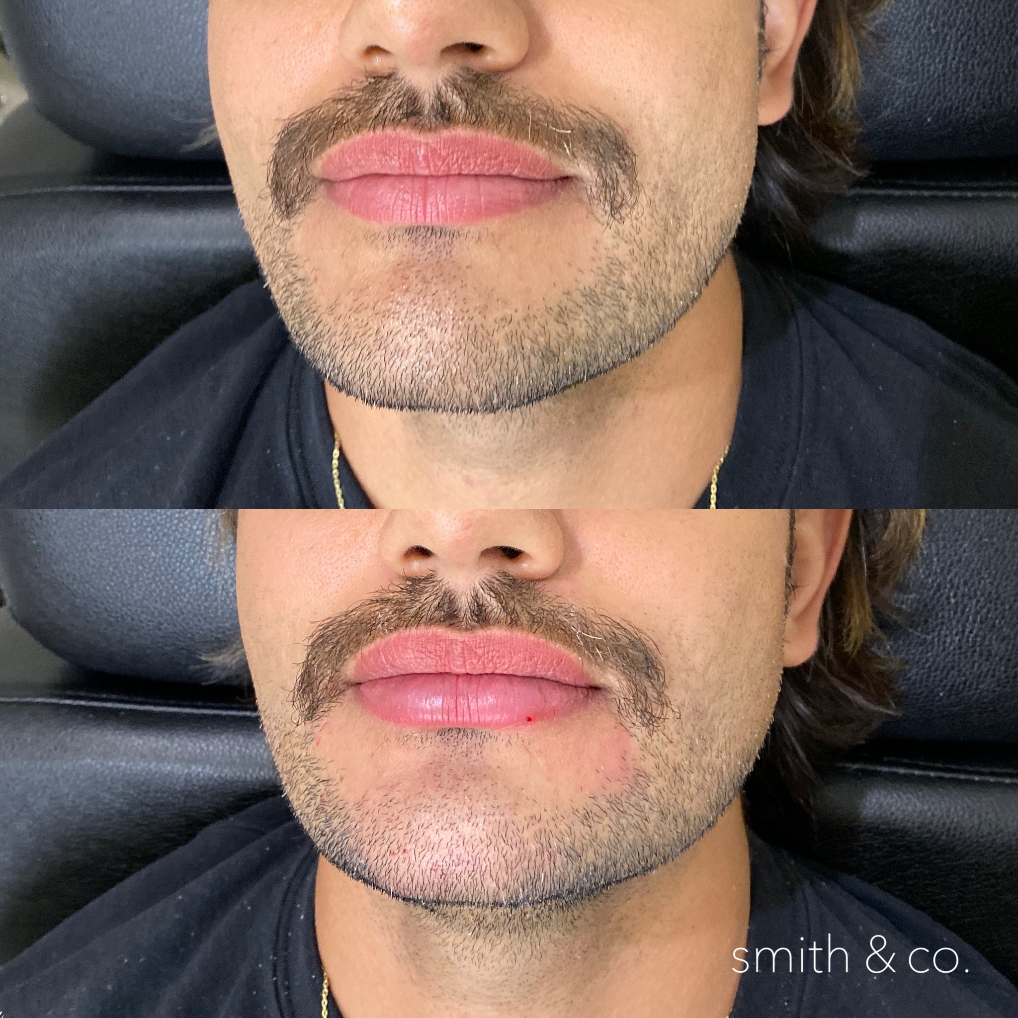 The New Lip Technique Danielle Smith Np