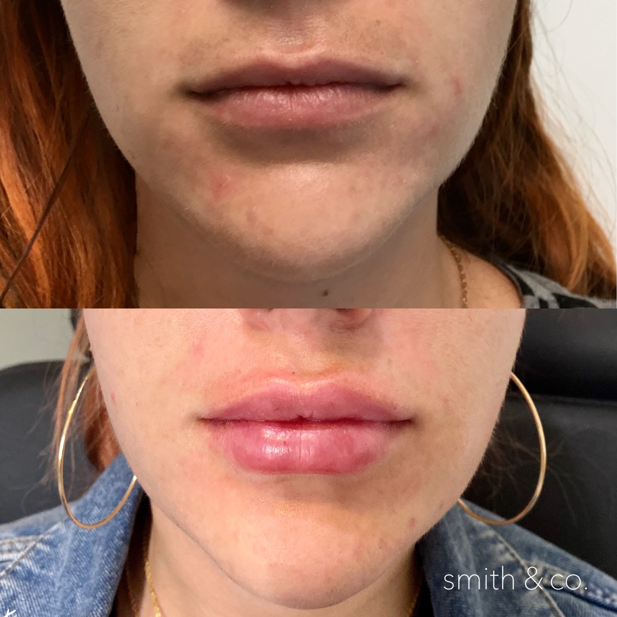 smith & co best botox and filler in miami_1963.PNG