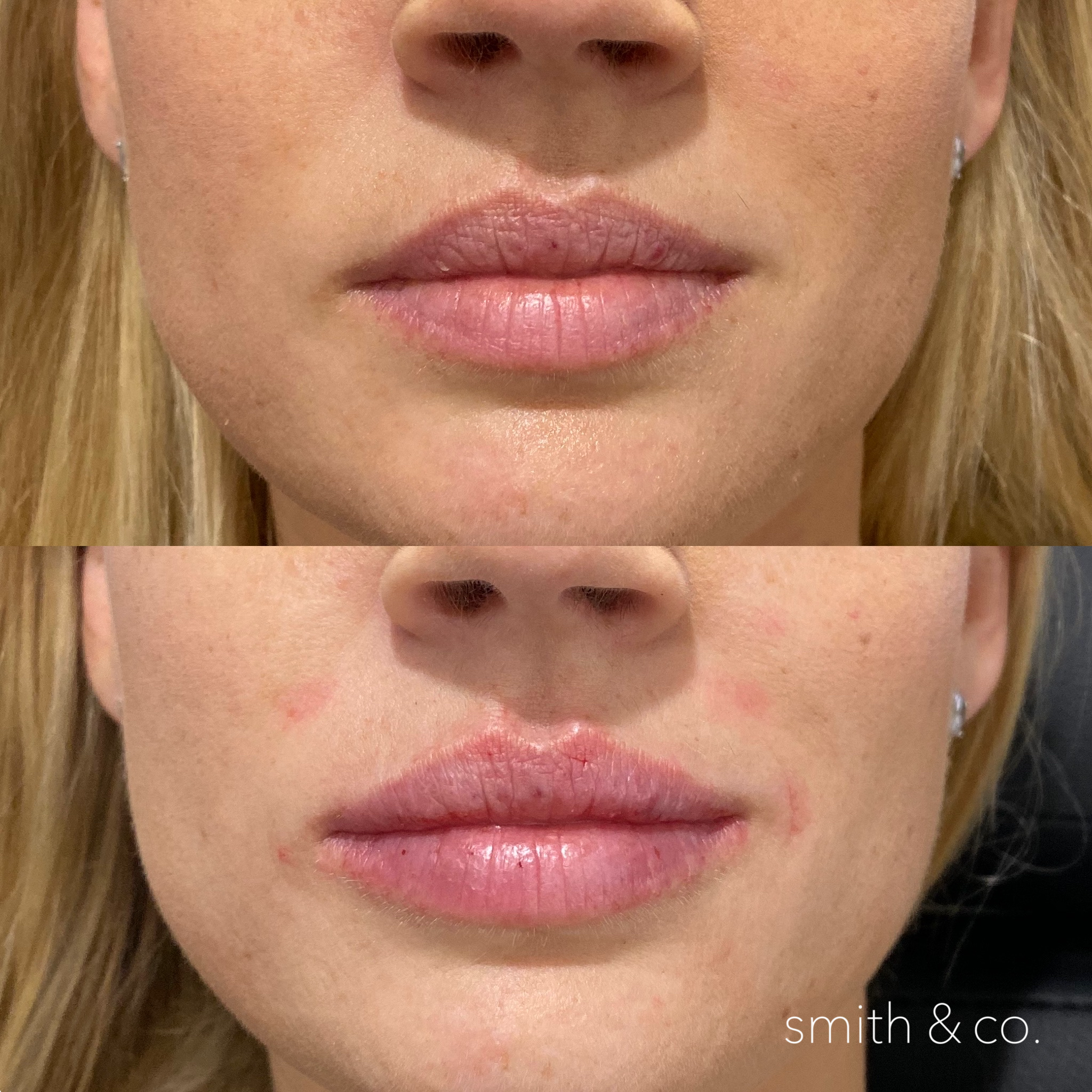 smith & co best botox and filler in miami_2172.PNG